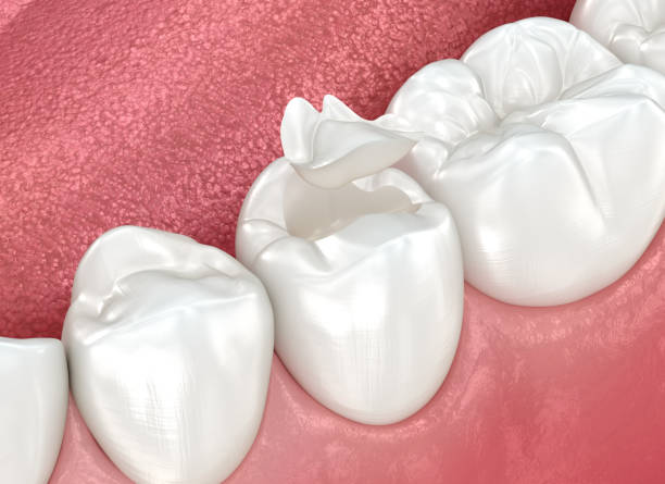 Best Dental Studio in Kendall, FL